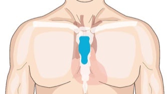 Torso showing correct vertical placement of strip