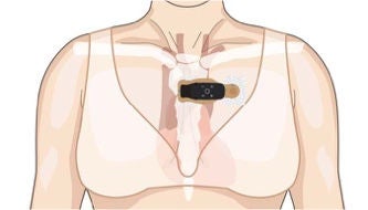 Female torso showing correct horizontal placement of strip