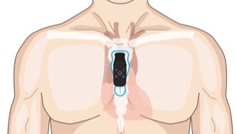 Torso showing correct vertical placement of strip