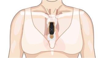 Torso showing correct vertical placement of bridge