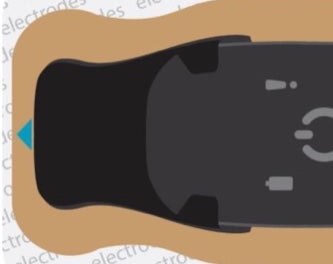 Close-up of BodyGuardian being adequately connected to Bridge
