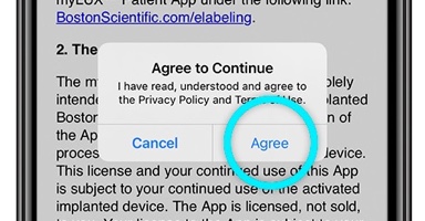 iPhone showing the terms and conditions page with the agree button highlighted