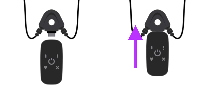 Connecting of BodyGuardian to ECG lead set