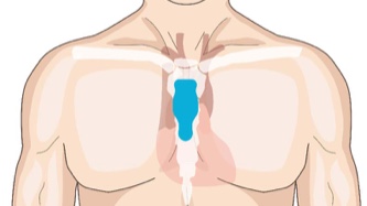 Torso showing correct vertical placement of strip