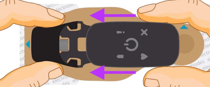 BodyGuardian being connected to the bridge